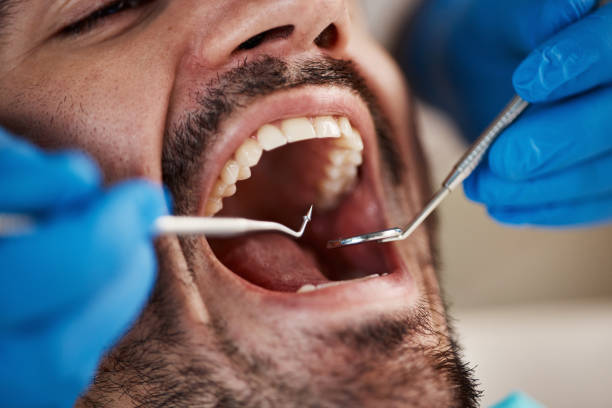 Best Dentist for Tooth Abscess  in Grafton, ND