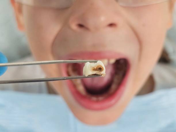 Best Broken Tooth Emergency  in Grafton, ND