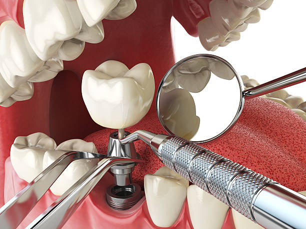 Best Broken Tooth Emergency  in Grafton, ND